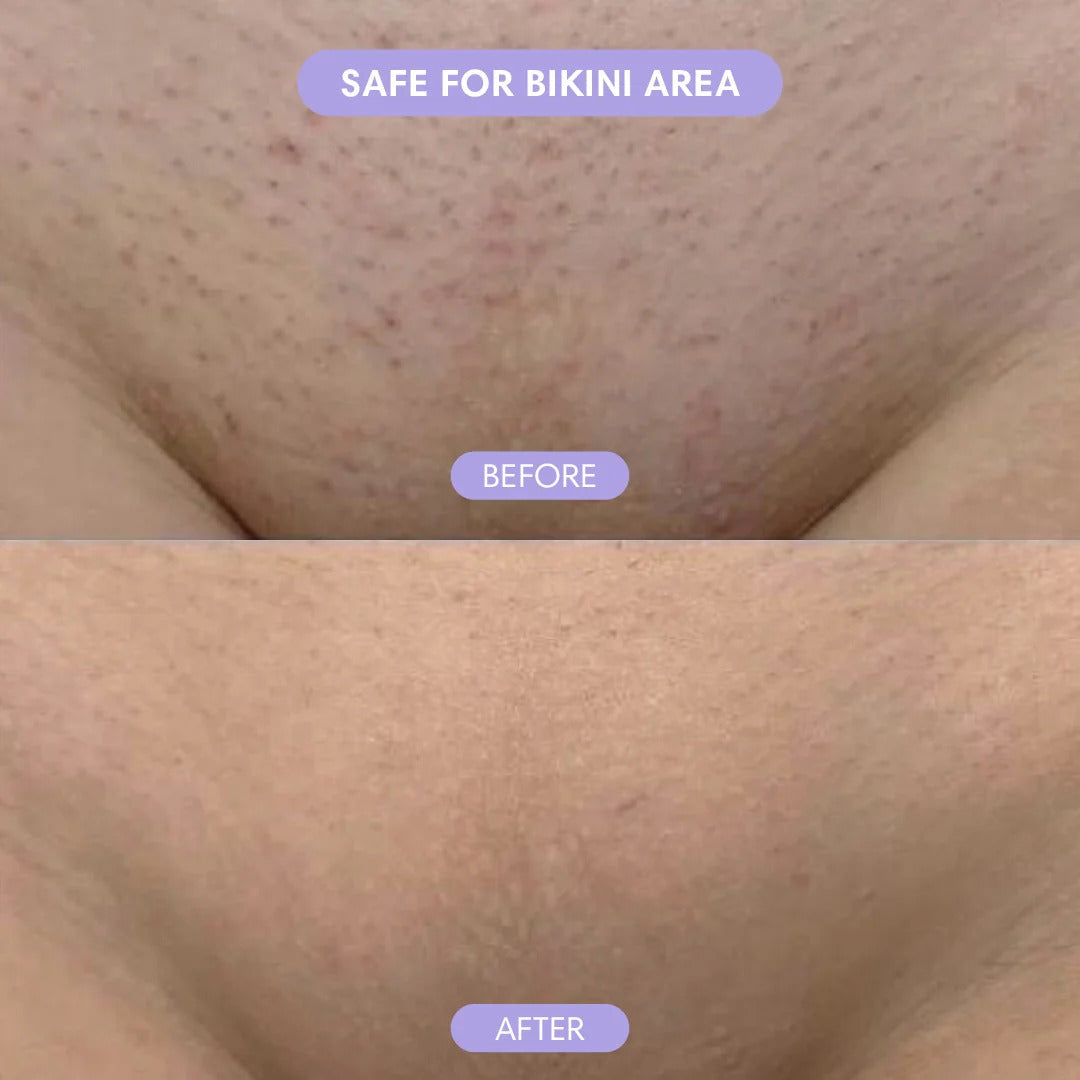 Hypoallergenic Formula-Gentle & Fast-Acting Depilatory with Citrus Scent