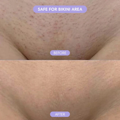 Hypoallergenic Formula-Gentle & Fast-Acting Depilatory with Citrus Scent
